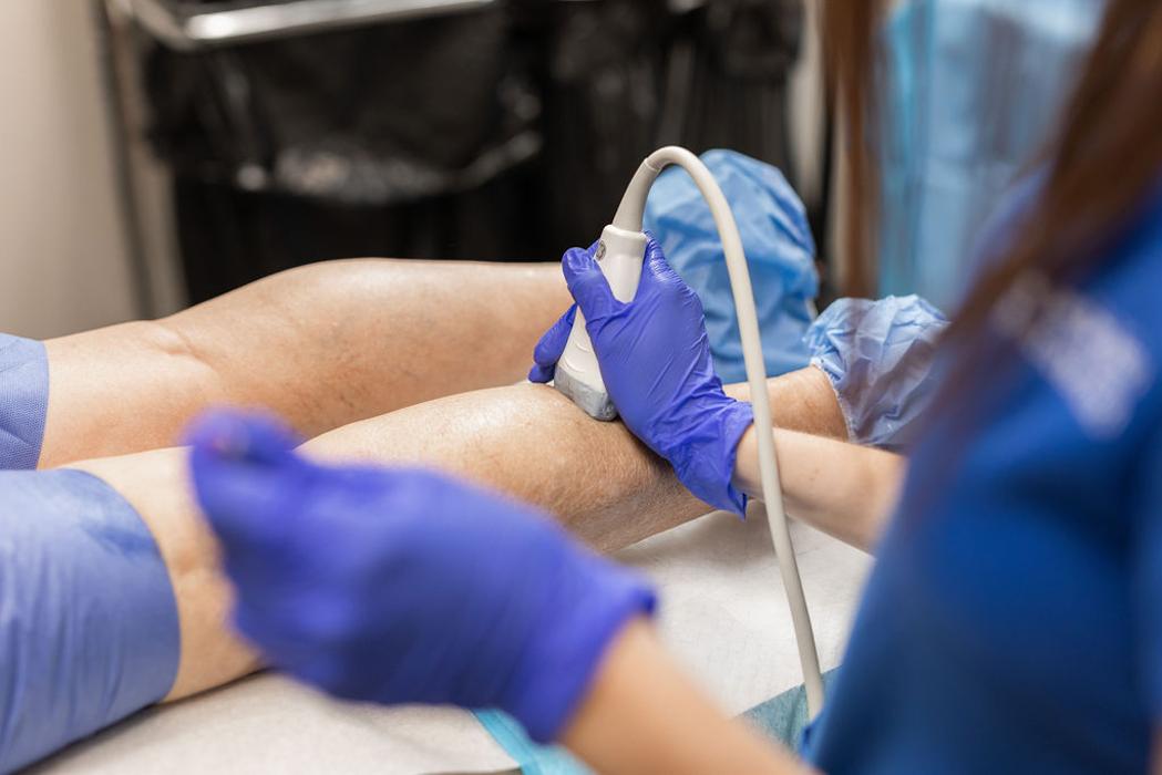 Center for Vein Restoration | Dr. Robert Fried - Rehoboth Beach, DE