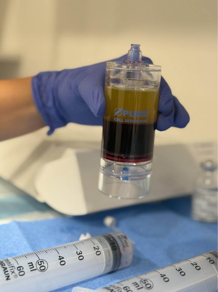 PRP Hair Restoration and Joint Injections!