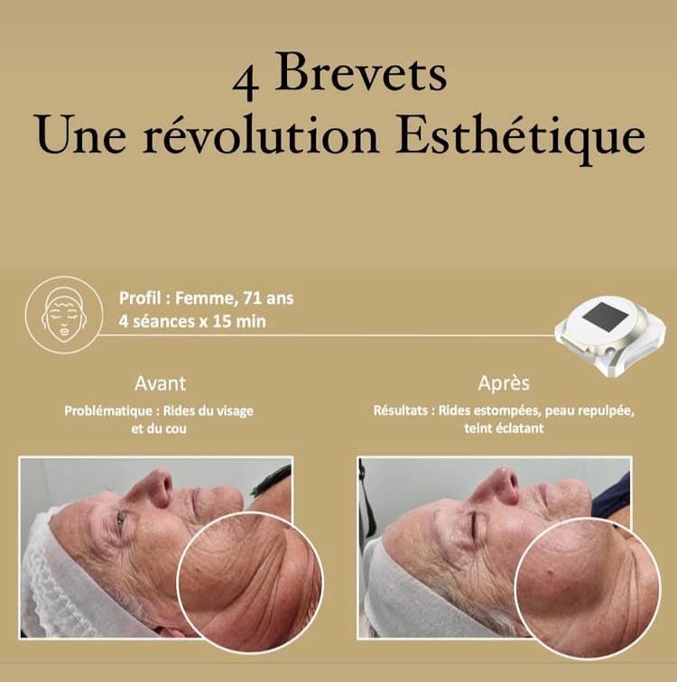 galerie image galerie image