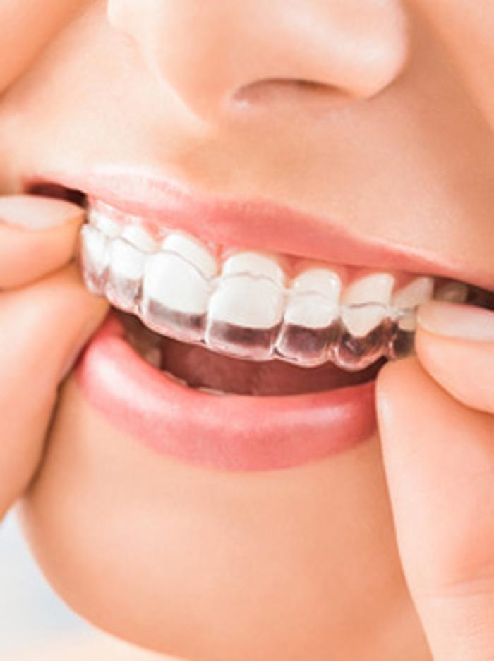 Inspire Dental of Roswell Image