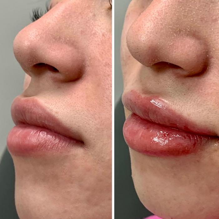 dermani MEDSPA Peachtree Corners - Norcross, GA