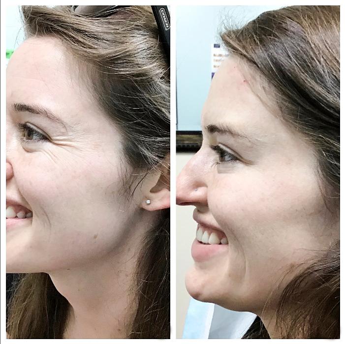 dermani MEDSPA Peachtree Corners - Norcross, GA