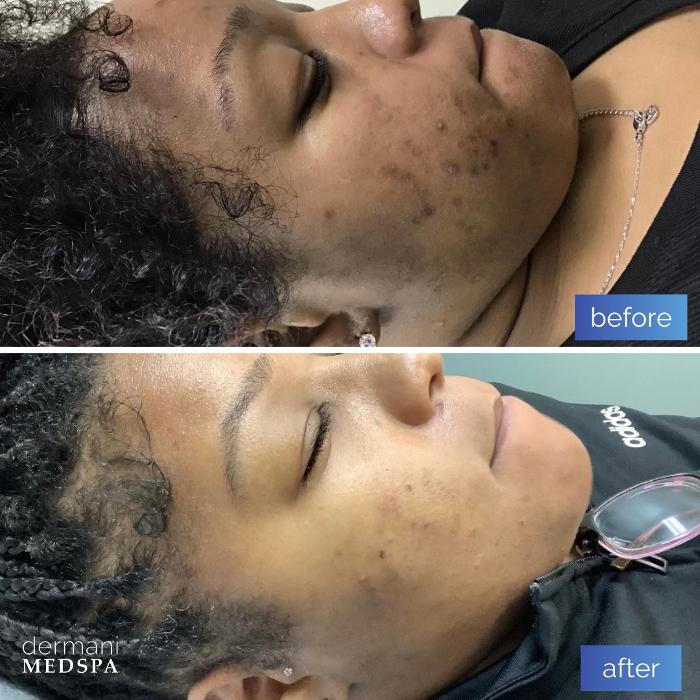 dermani MEDSPA Peachtree Corners - Norcross, GA