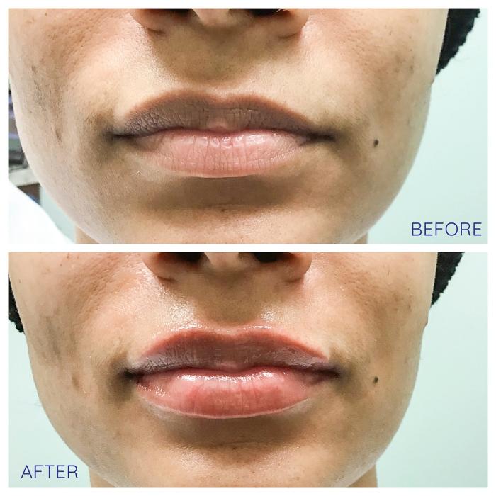 dermani MEDSPA Cumming - Cumming, GA