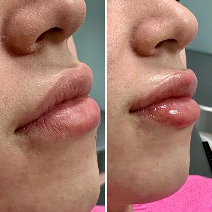 dermani MEDSPA Cumming - Cumming, GA