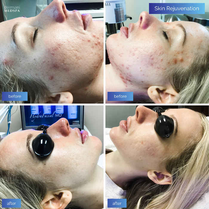 dermani MEDSPA - Buford, GA