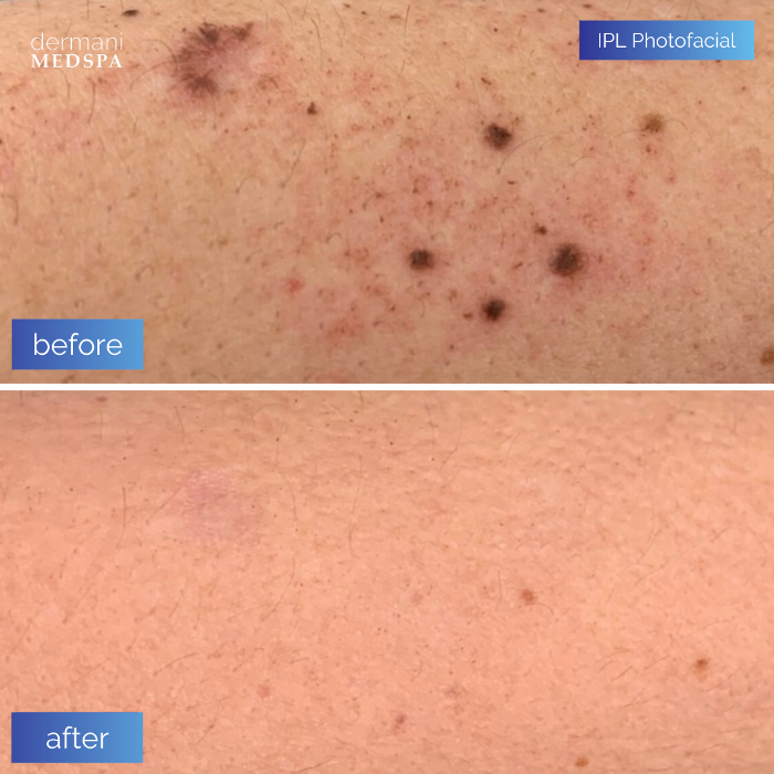 dermani MEDSPA - Buford, GA