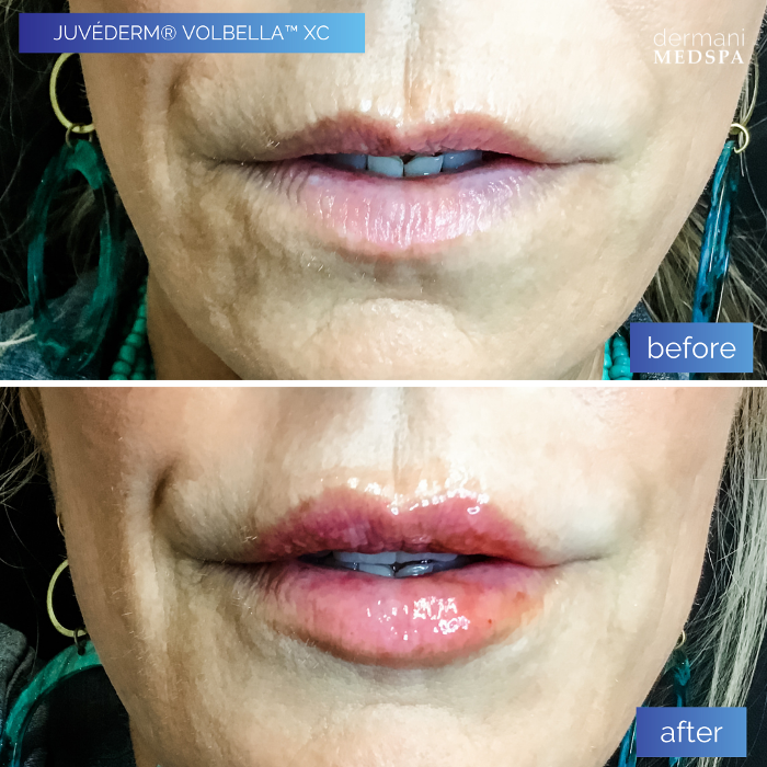 dermani MEDSPA - Buford, GA