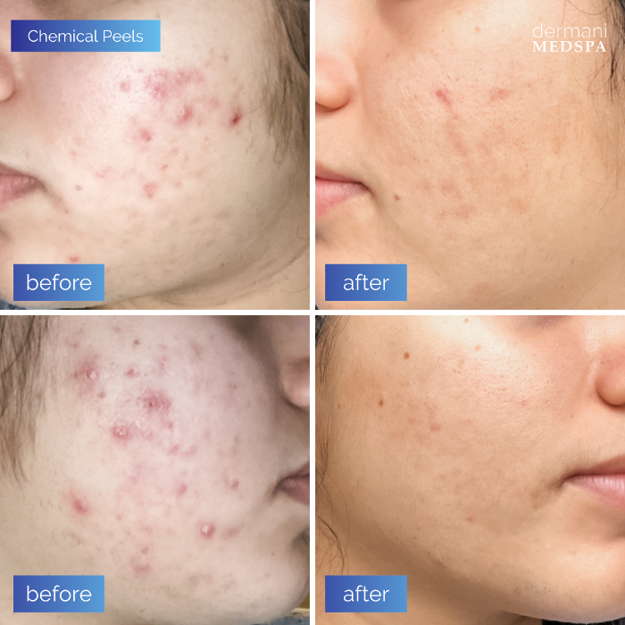 dermani MEDSPA - Buford, GA