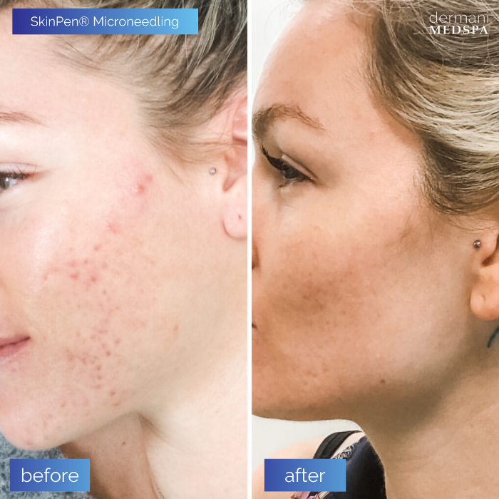 dermani MEDSPA - Buford, GA