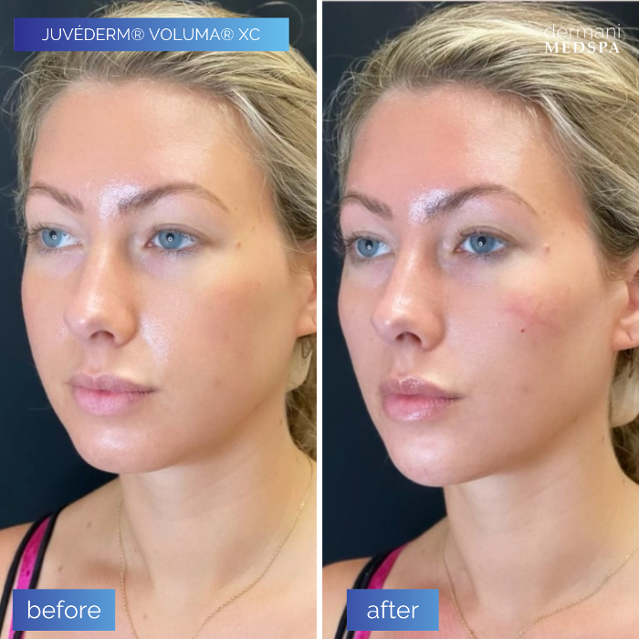 dermani MEDSPA - Buford, GA