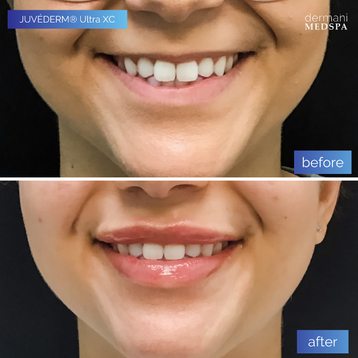 dermani MEDSPA - Buford, GA