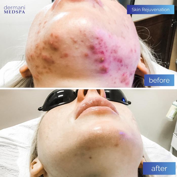 dermani MEDSPA - Buford, GA