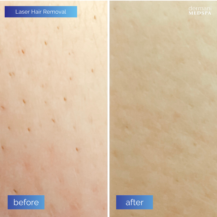 dermani MEDSPA - Buford, GA