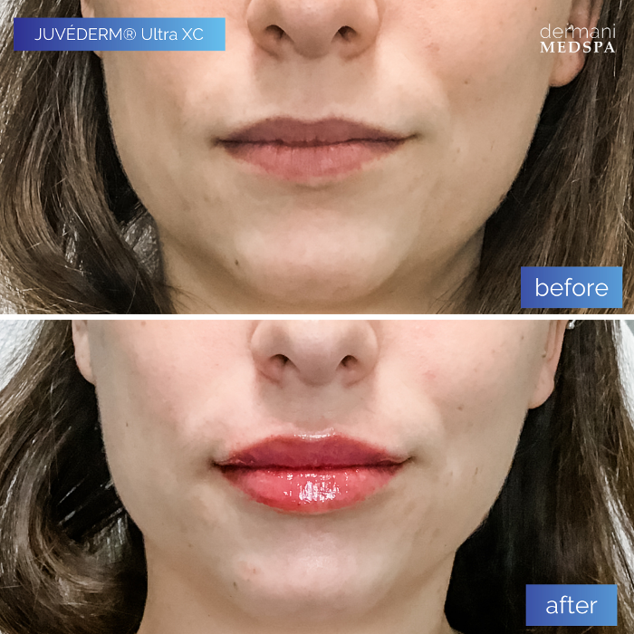 dermani MEDSPA - Buford, GA