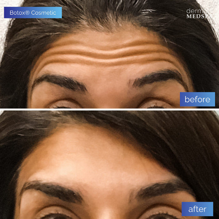 dermani MEDSPA - Buford, GA