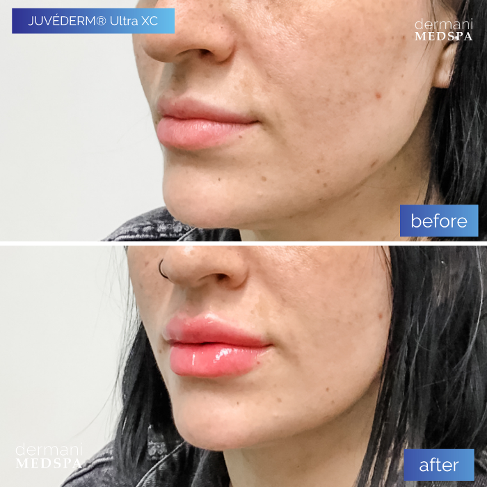 dermani MEDSPA - Buford, GA