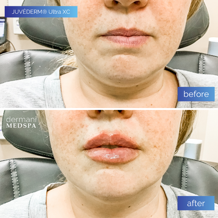 dermani MEDSPA - Buford, GA