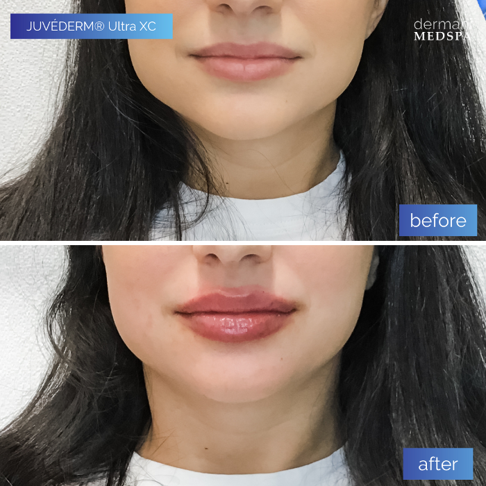 dermani MEDSPA - Buford, GA