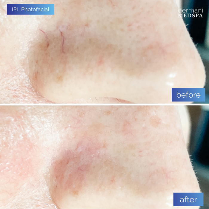 dermani MEDSPA - Buford, GA