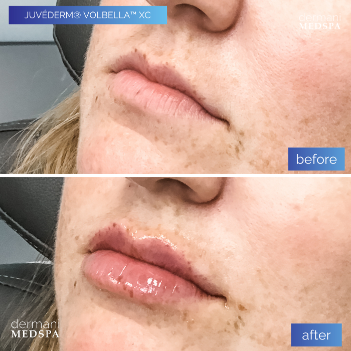 dermani MEDSPA - Buford, GA