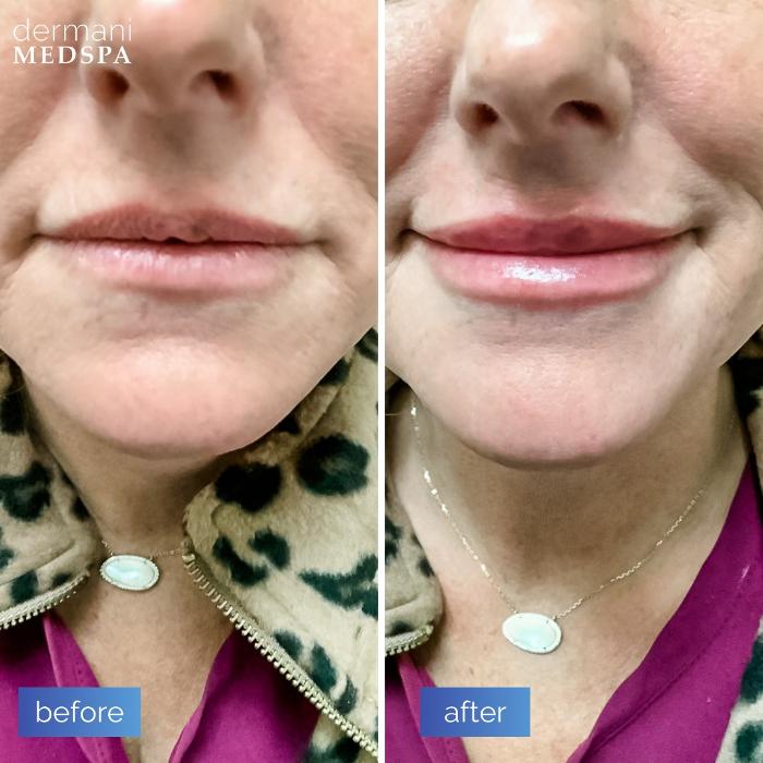 dermani MEDSPA - Buford, GA