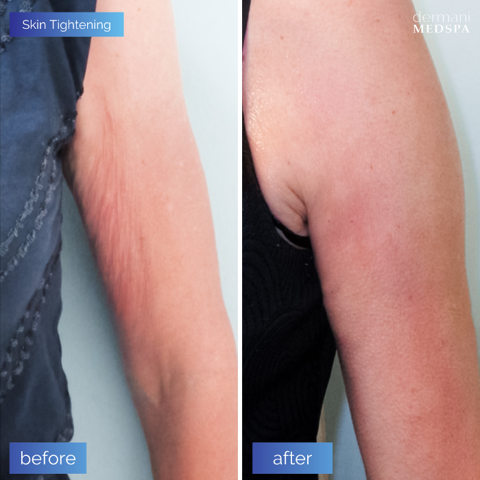 dermani MEDSPA - Buford, GA