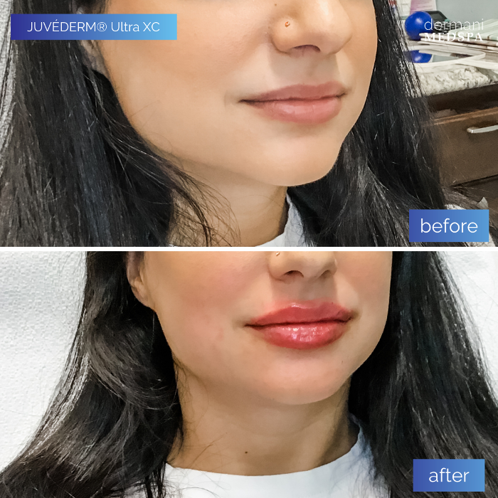 dermani MEDSPA - Buford, GA