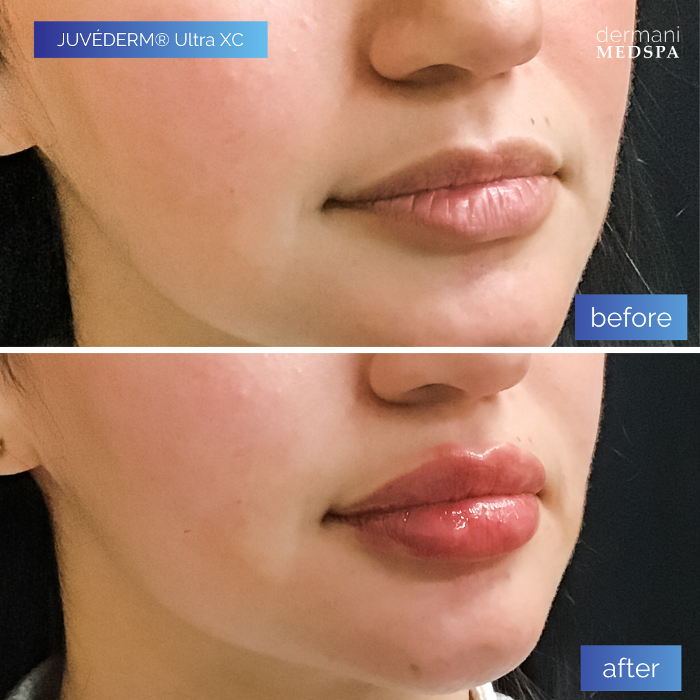 dermani MEDSPA - Buford, GA