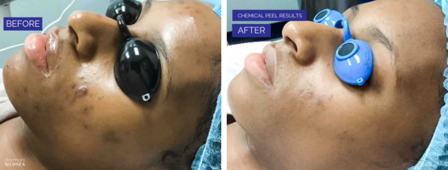 dermani MEDSPA Granger - Granger, IN