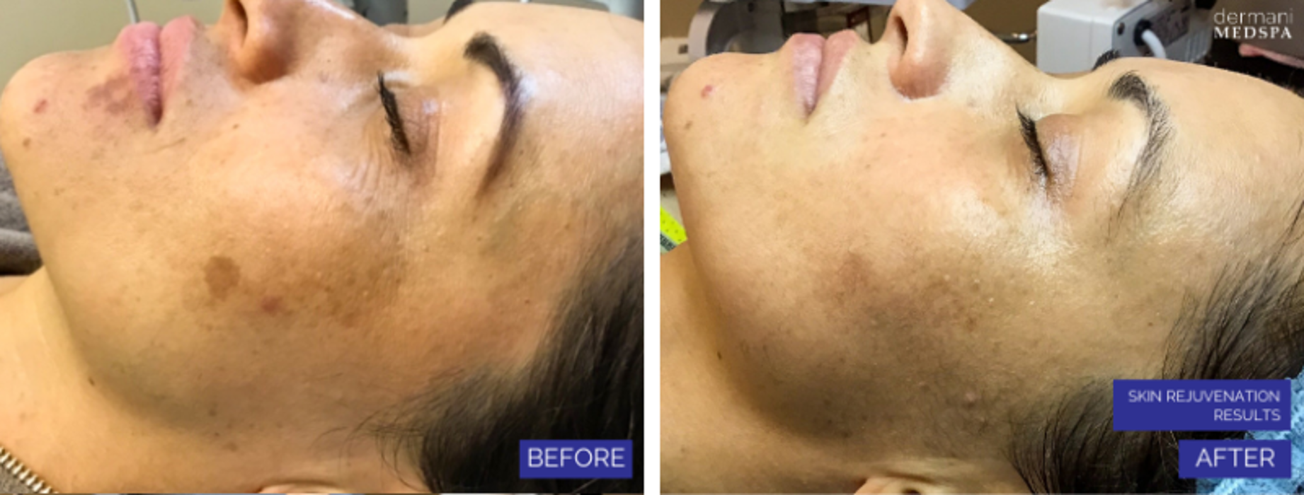 dermani MEDSPA Granger - Granger, IN