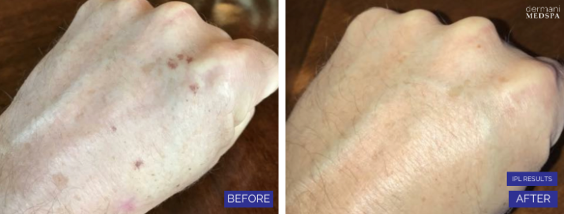 dermani MEDSPA Granger - Granger, IN