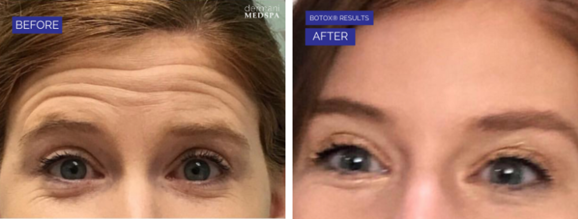 dermani MEDSPA Granger - Granger, IN