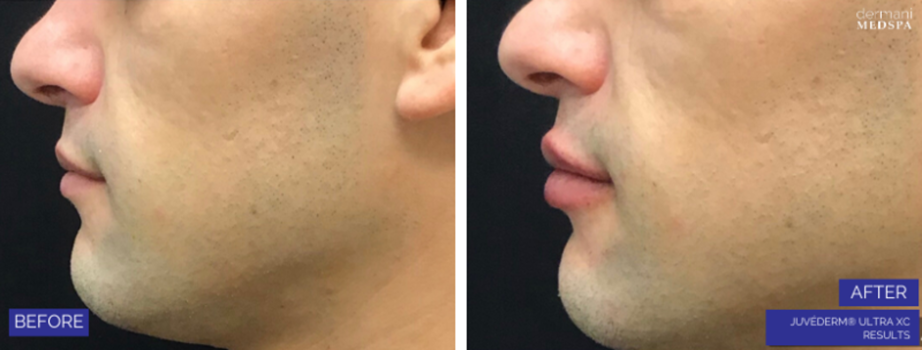 dermani MEDSPA Granger - Granger, IN