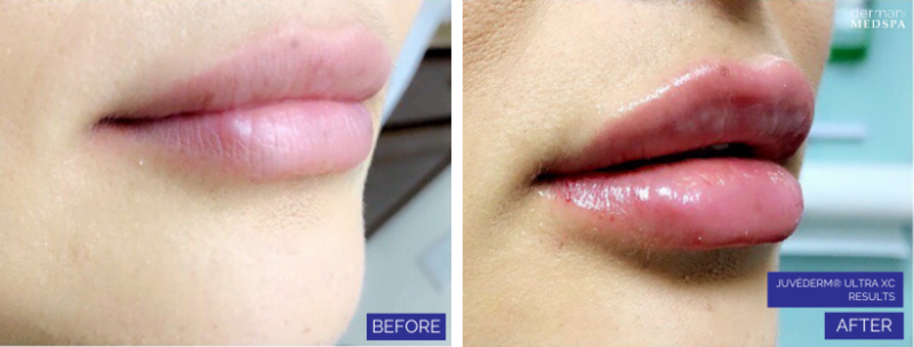 dermani MEDSPA Granger - Granger, IN