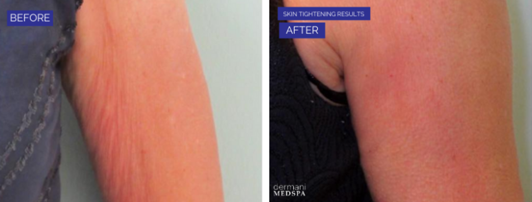 dermani MEDSPA Granger - Granger, IN