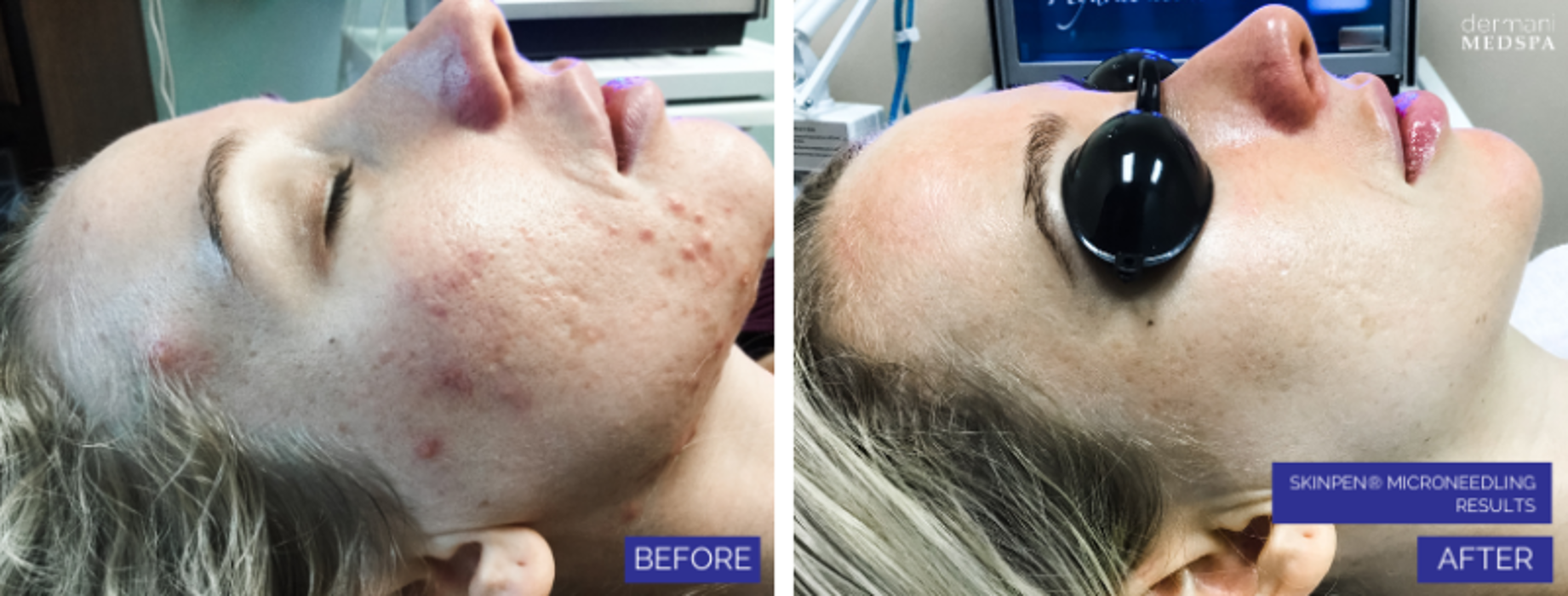 dermani MEDSPA Granger - Granger, IN