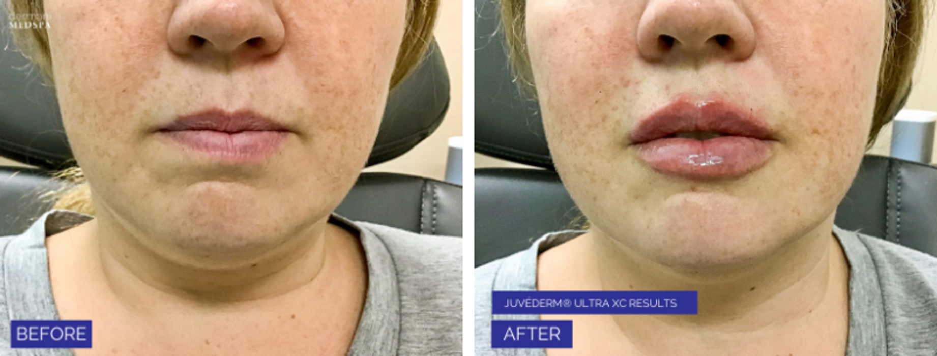 dermani MEDSPA Granger - Granger, IN