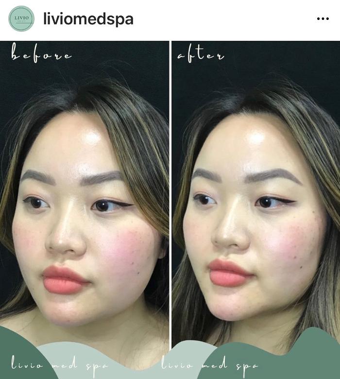 Livio Med Spa Image