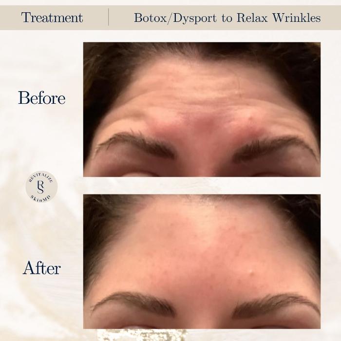 Revitalize SkinMD Image
