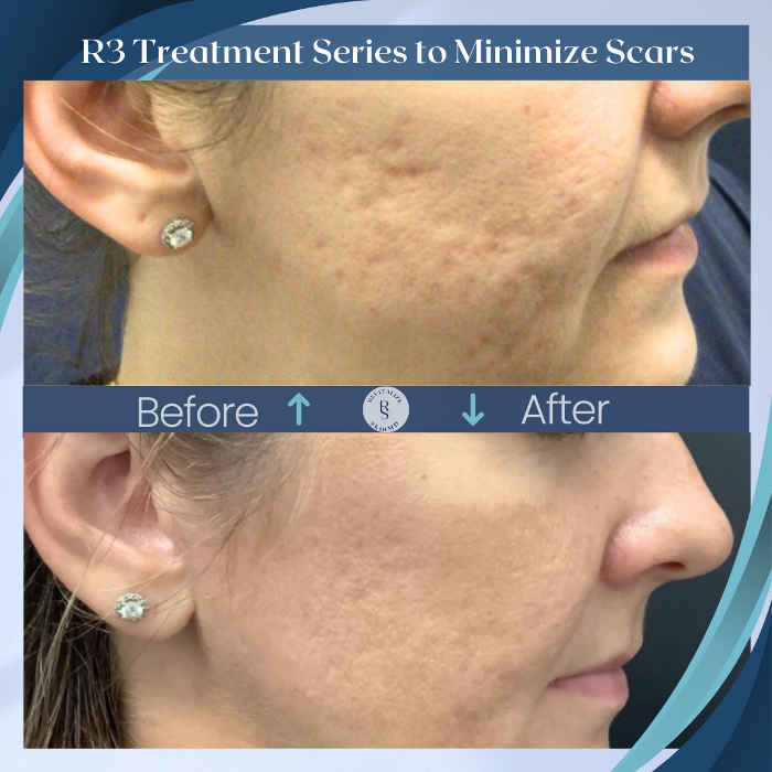 Revitalize SkinMD Image