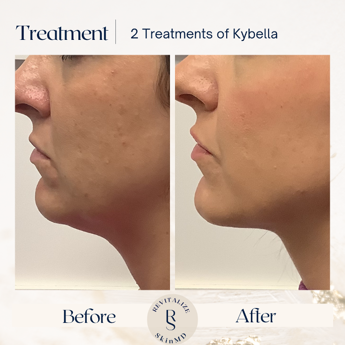 Revitalize SkinMD Image