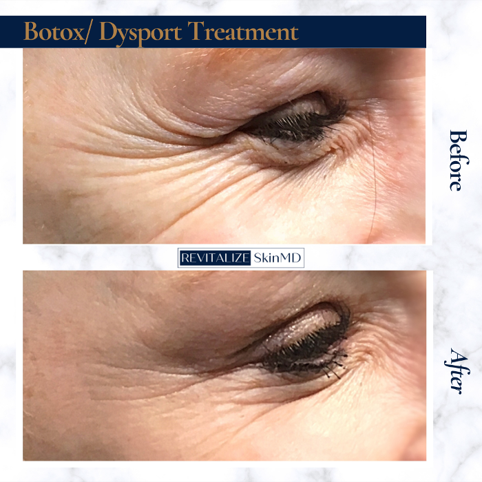 Revitalize SkinMD Image