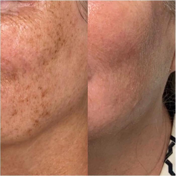 Glow Envy Med Spa - Midlothian, VA