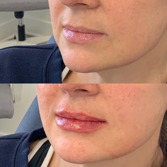 Glow Envy Med Spa - Midlothian, VA