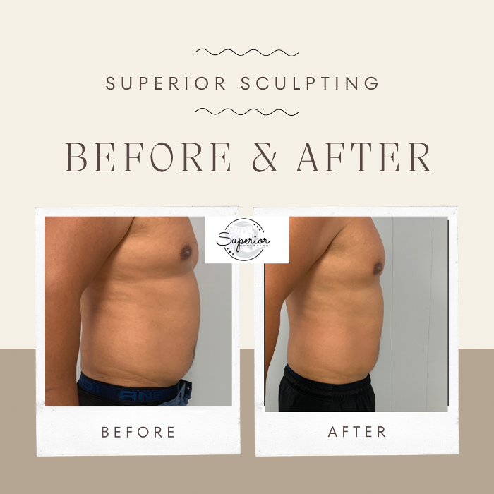 Superior Sculpting - Vero Beach, FL