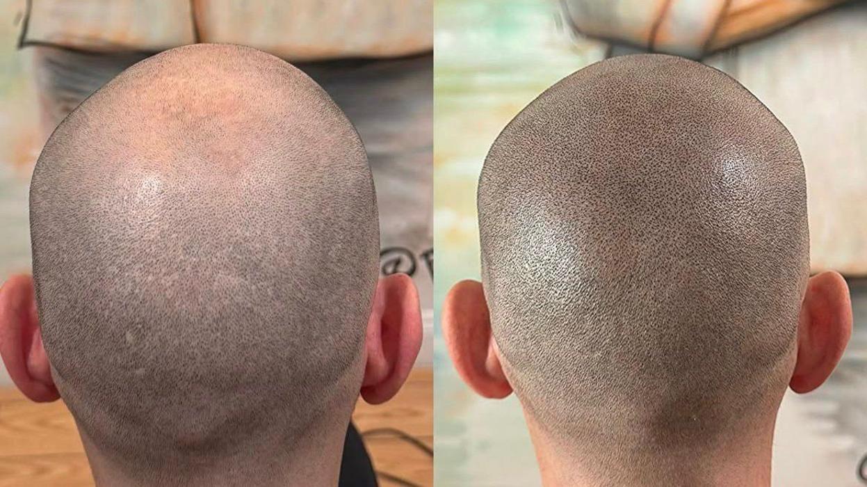 Dothair, Grubenstrasse in Zürich