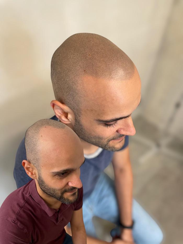 Dothair, Grubenstrasse in Zürich