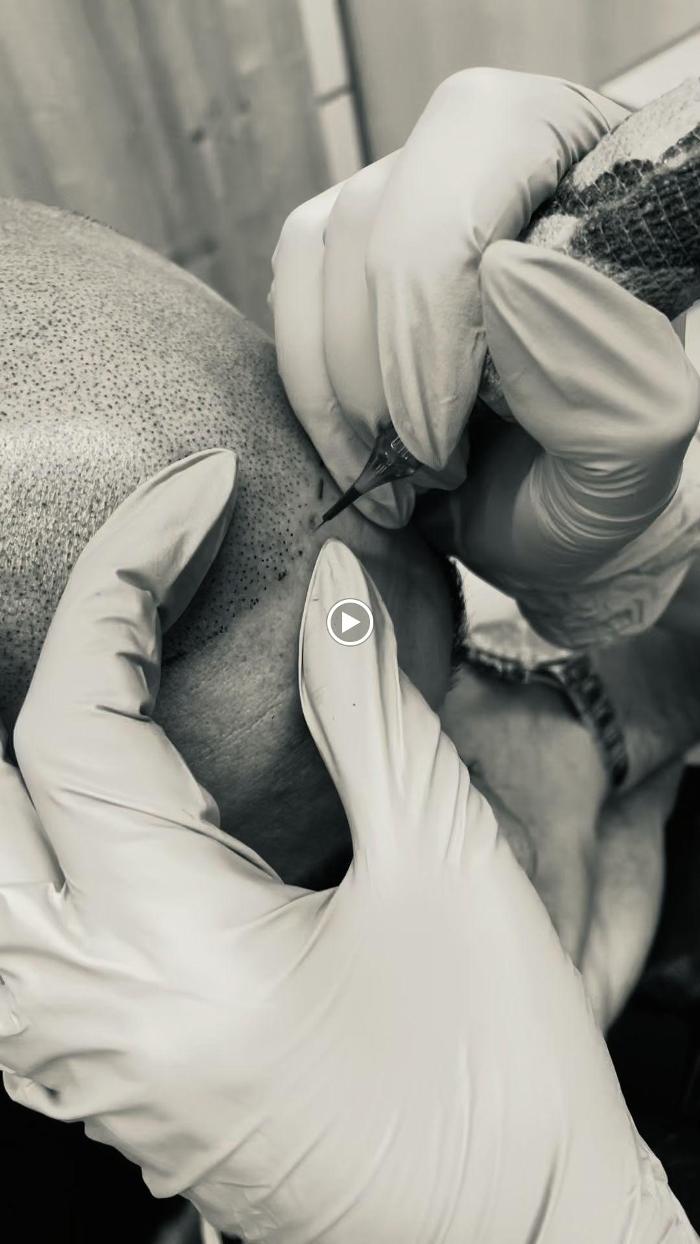 Dothair, Grubenstrasse in Zürich