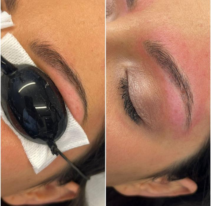Professional eyebrow microblading at The De Peyer Clinic in Durley, Southampton, showing precise hair stroke work and freshly enhanced brows.